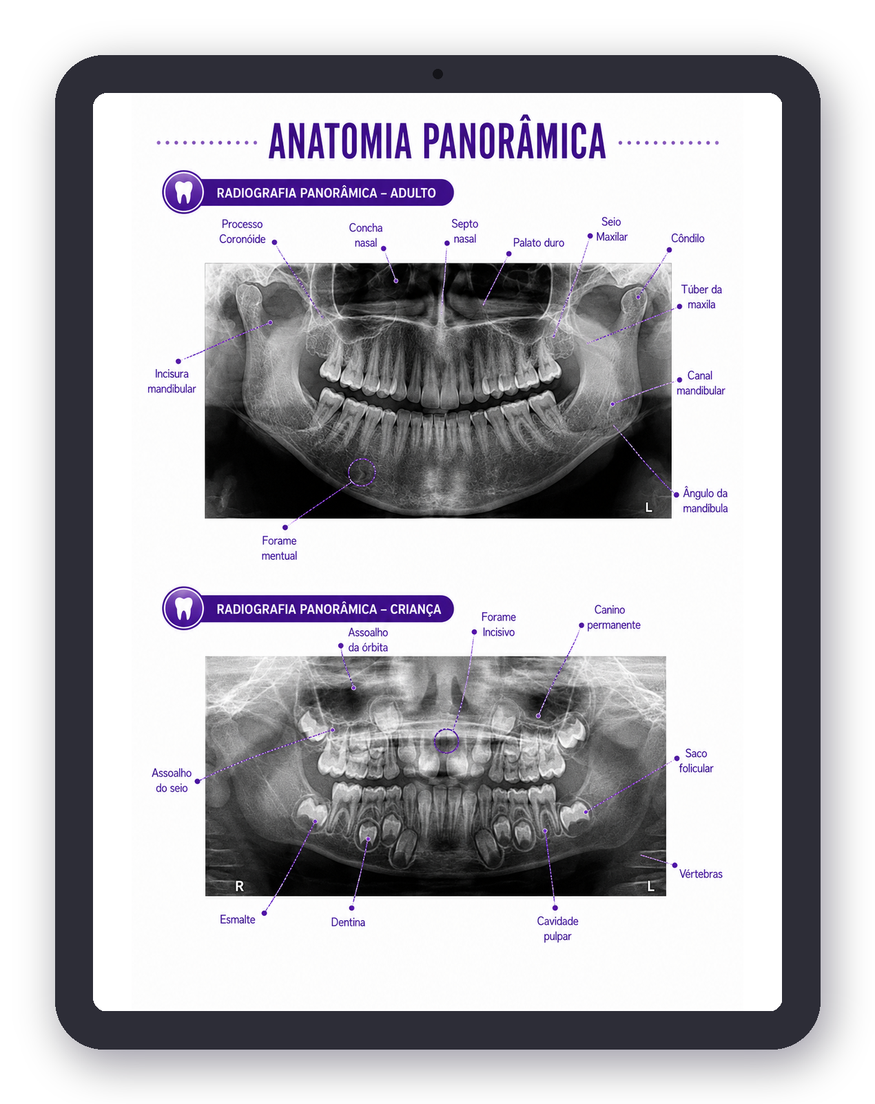 Prévia de Radiologia em iPad
