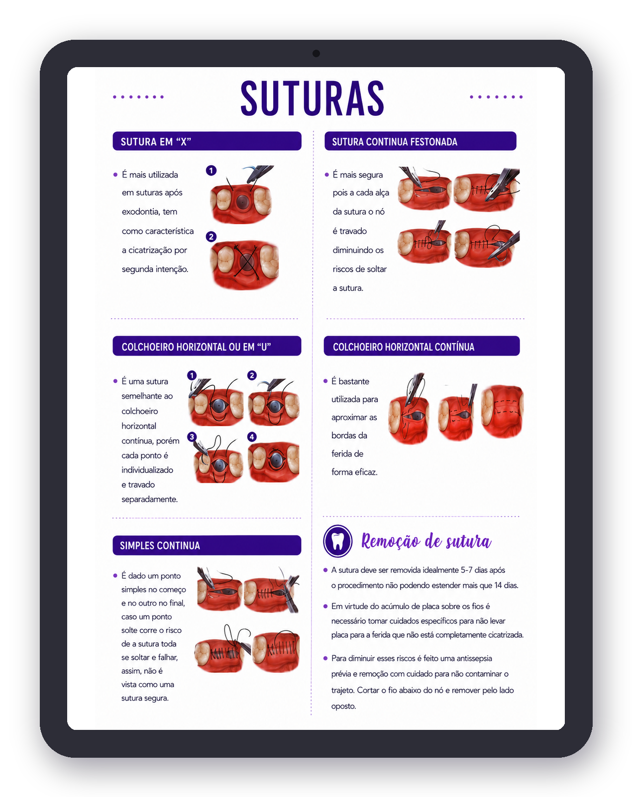 Prévia de Cirurgia Oral em iPad